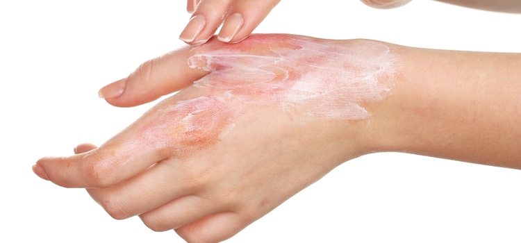 Cicatrizantes - TIENDA PIEL