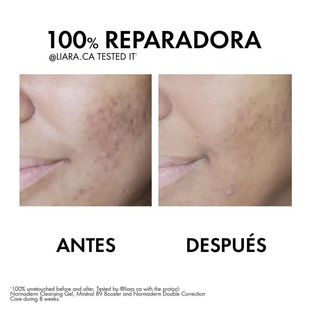 Vichy Crema Hidratante Normaderm Anti-Imperfecciones x50ml