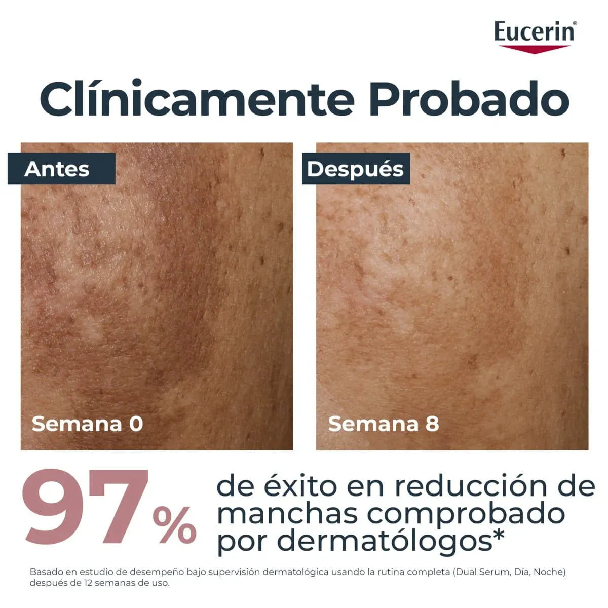Sérum Eucerin Anti-Pigment Dual 30 ml