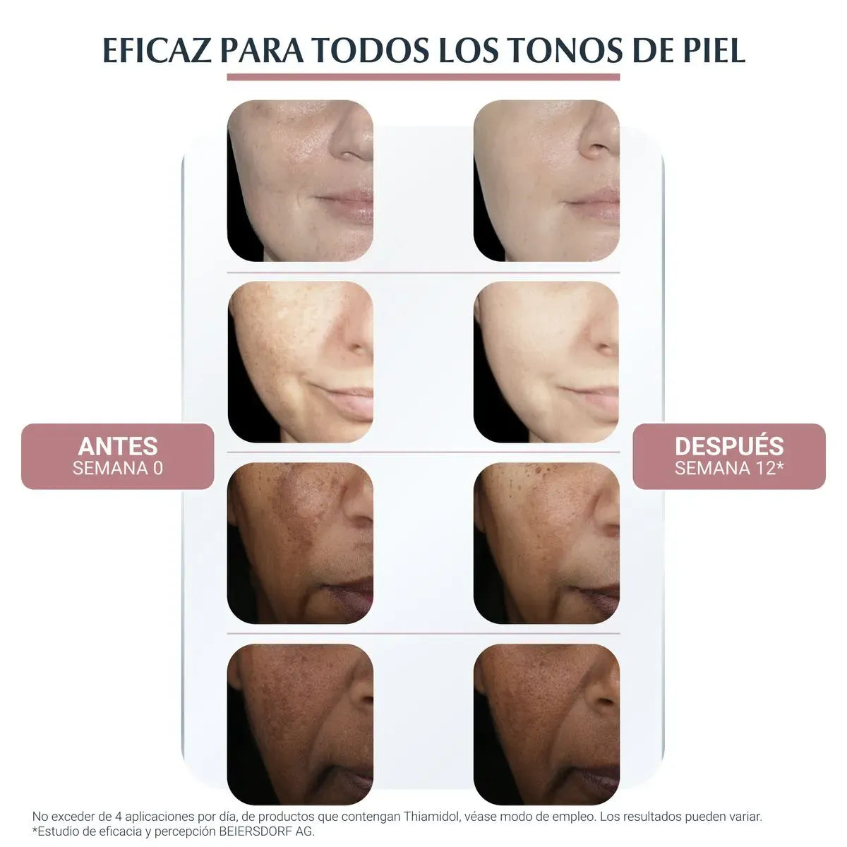Anti-Pigment Ultra-Light Serum antimanchas - Eucerin 30 ml