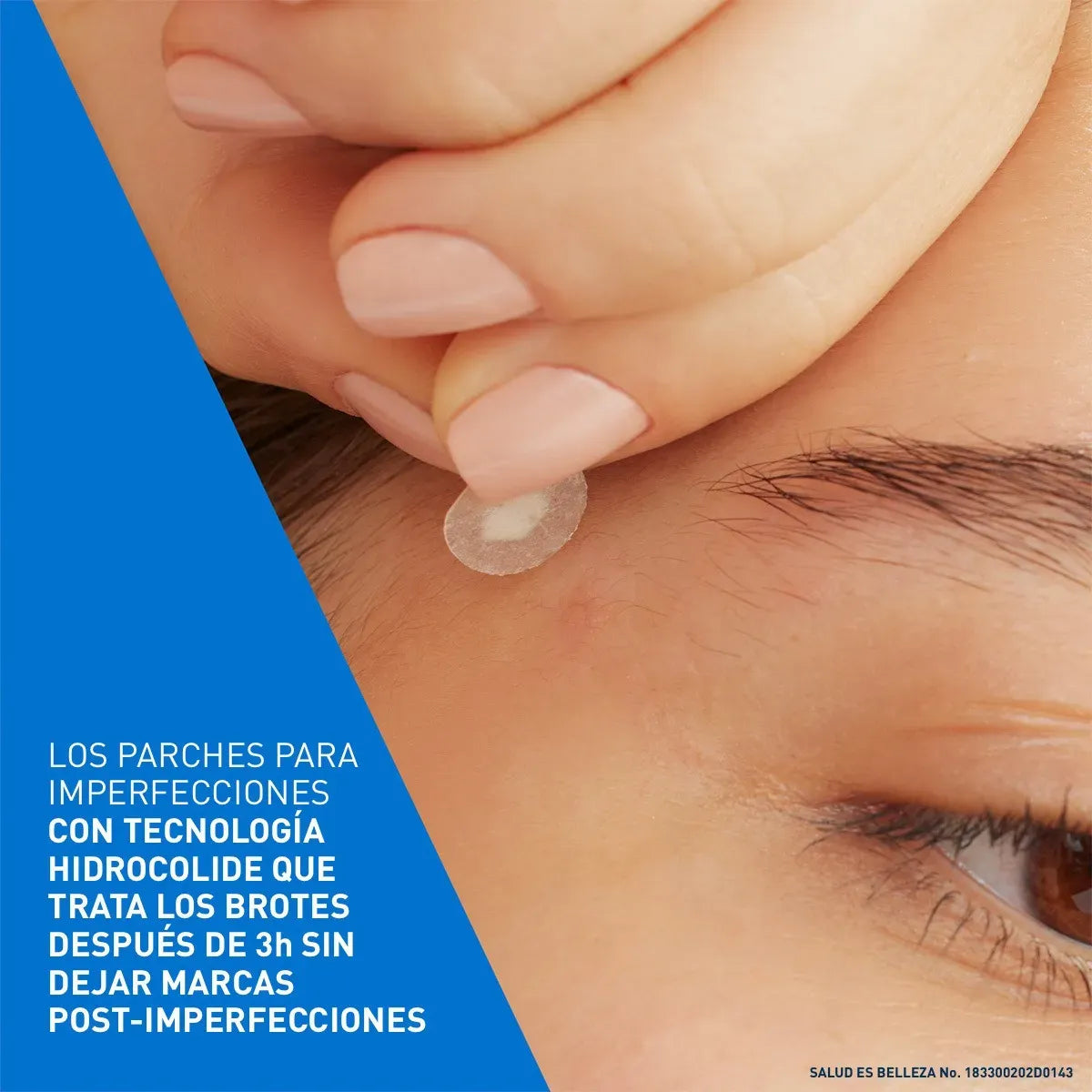 Cerave Parches Control Imperfecciones X 22 Unidades