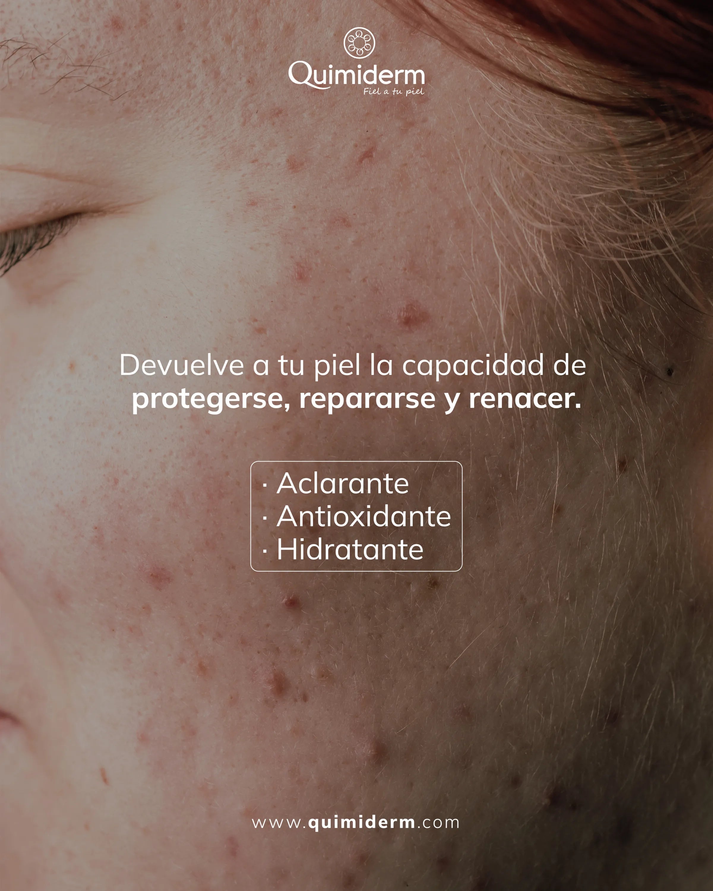 Quimiderm Melanostop Forte Serum x 30gr