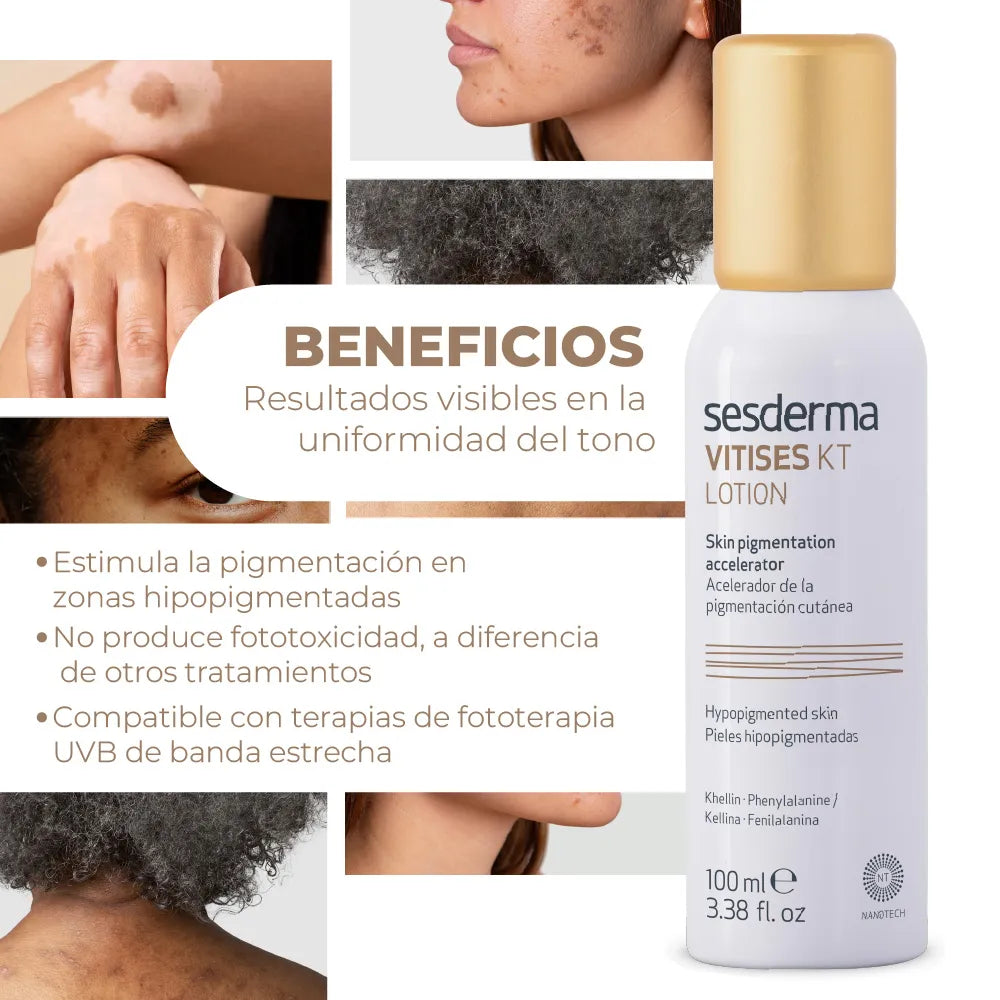 Sesderma Vitises Kt Lotion x100ml