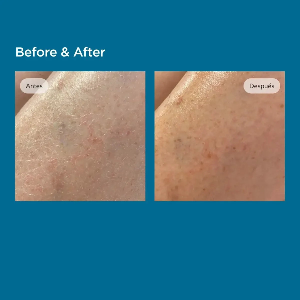 Isdin Ureadin Loción 10 Hidratante Piel Seca x1Lt