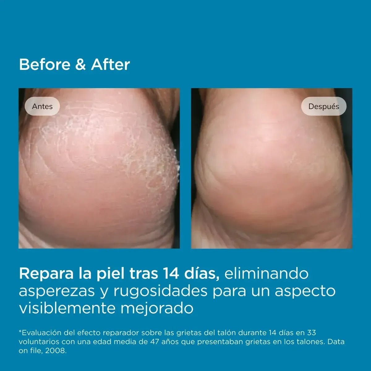 Isdin Ureadin Podos Gel Oil Hidratante x75ml - Tienda Piel