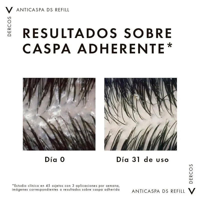 Vichy Dercos Technique Shampoo Anticaspa Refill x500ml - TIENDA PIEL
